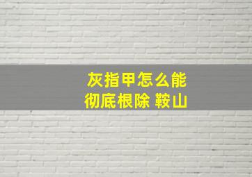 灰指甲怎么能彻底根除 鞍山